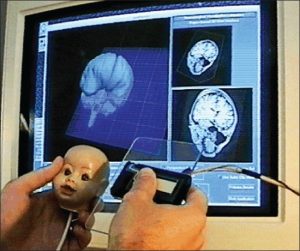 Acryclic plane interface to Brain Imaging software